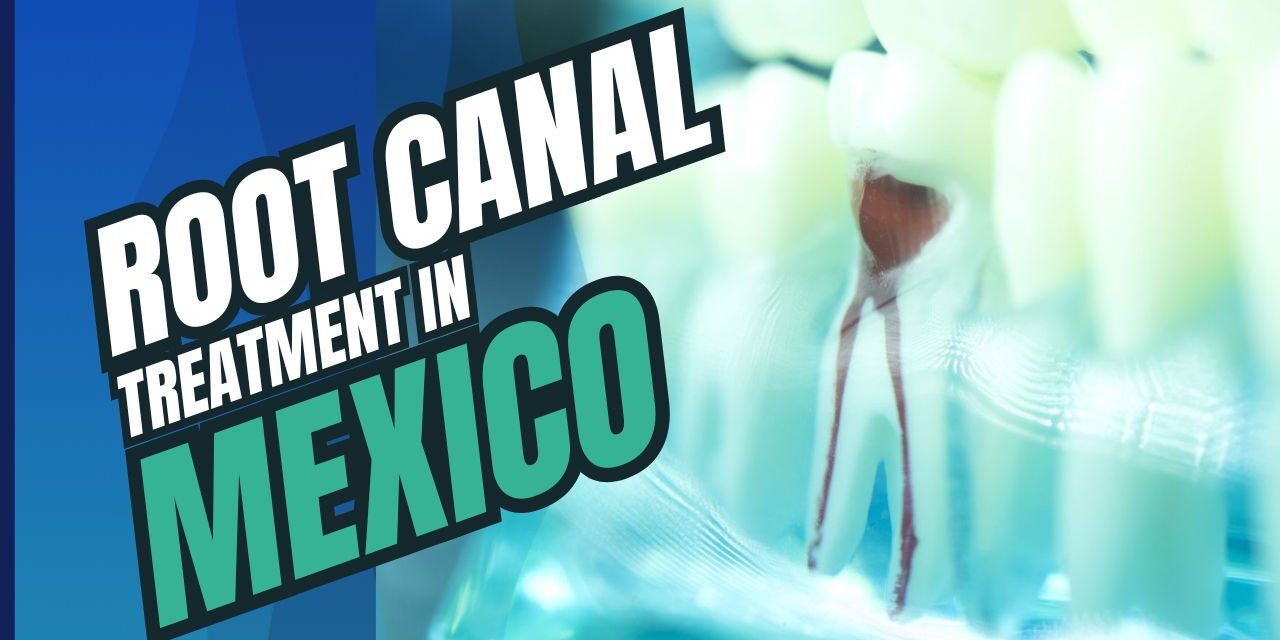 Root Canal Treatment in Mexico: Why It’s the Best Option